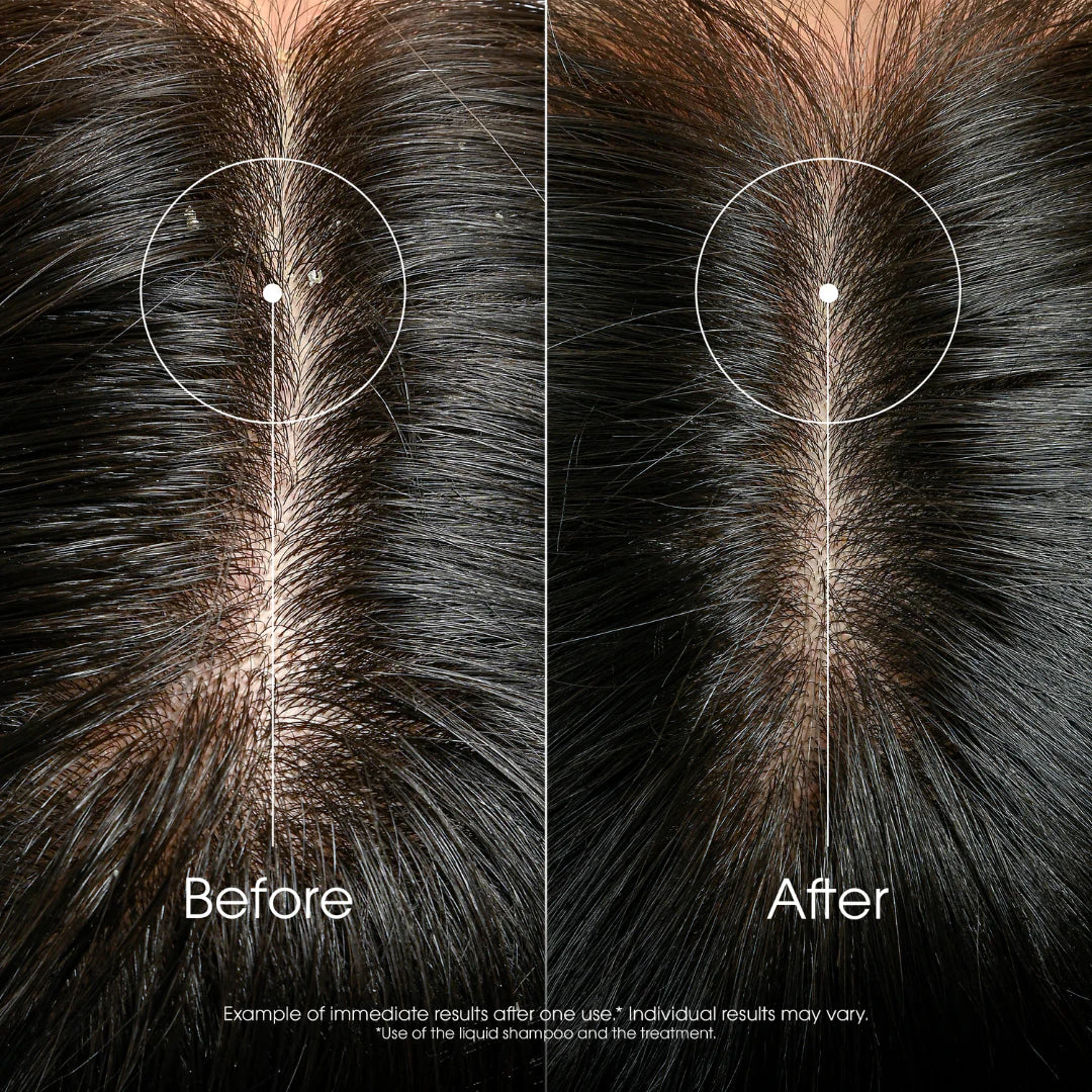 Klorane Anti-Dandruff Rebalancing & Treating Shampoo With Galangal